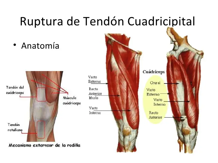 Photo of Anatomía de los músculos del cuádriceps