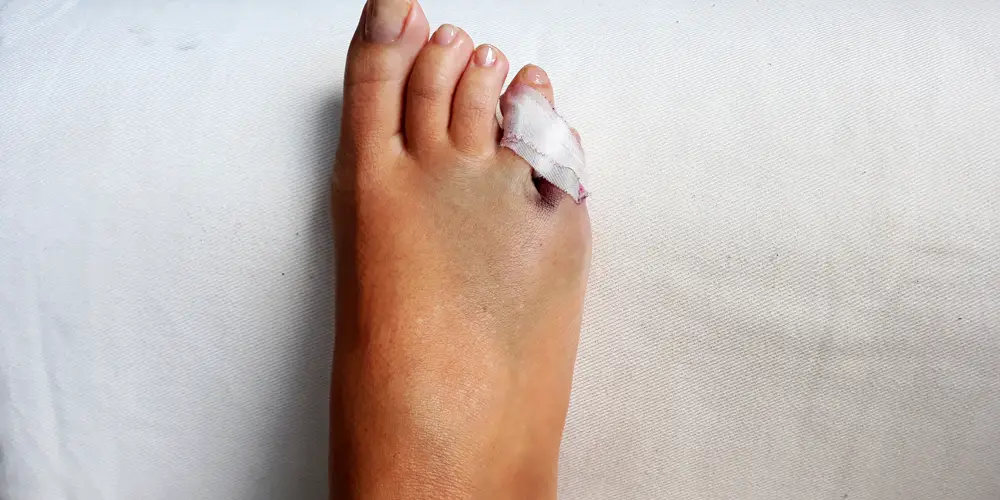 Photo of Cómo cambiar el golpe de los pies para evitar lesiones