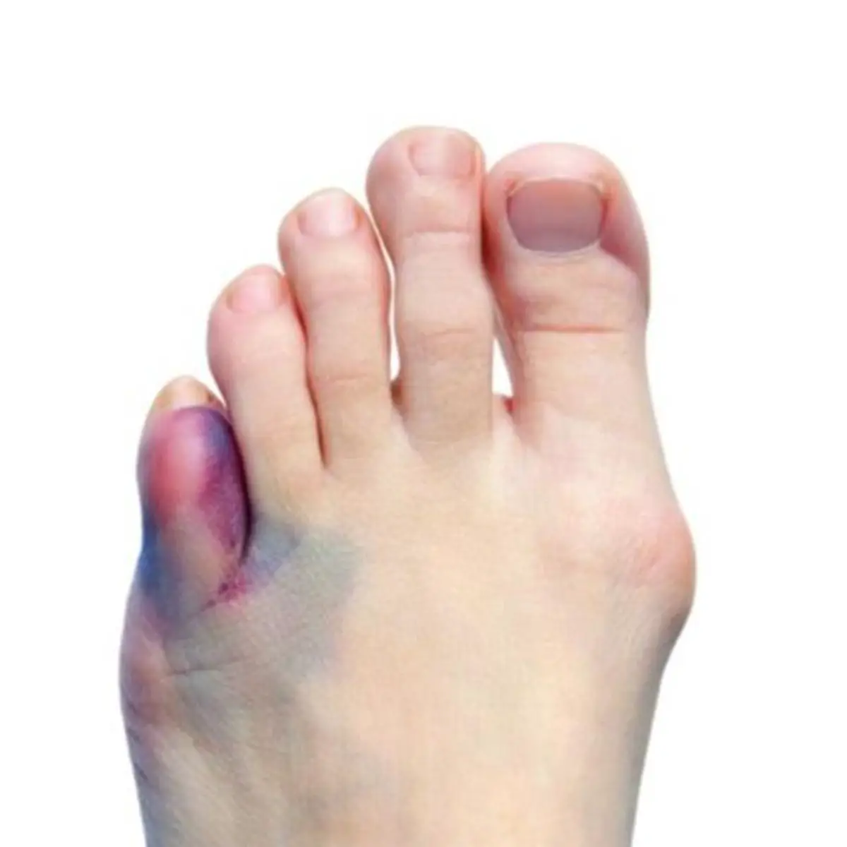 Photo of Cómo hacer golpecitos en los dedos de los pies