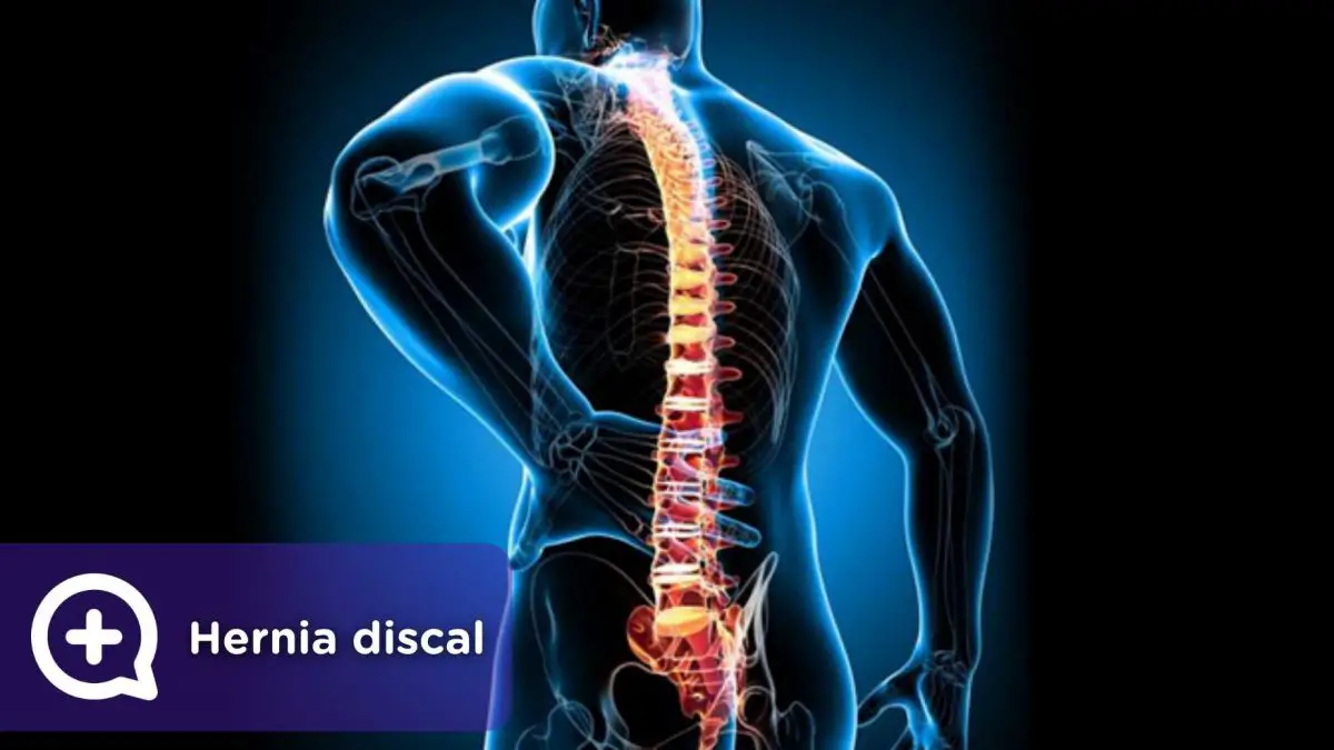 Photo of Los síntomas hernia deportiva, Pruebas y Tratamiento