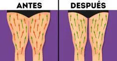 Photo of Trucos de dieta y ejercicios para mejorar la apariencia de los «Cankles».